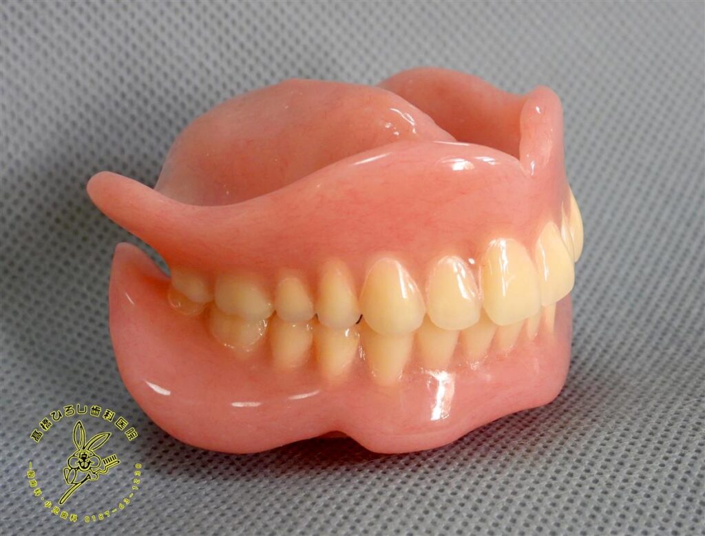 デンチャースペース義歯