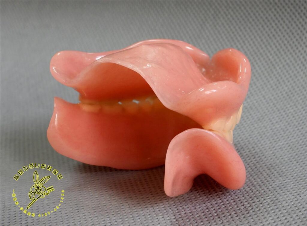 デンチャースペース義歯